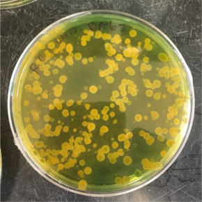 Uh oh, Vibrio: Not your grandma’s bloomers